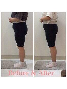 スタイルラボ高松/産後の骨盤矯正の効果♪