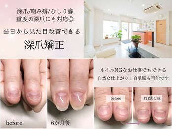 インブロッサム(imblossom)