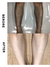 メロウ(mellow)/メンズ脚☆6回施術