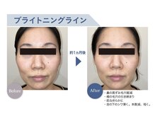 リノア 堀江(Linoa)/FAITH ブライトニング