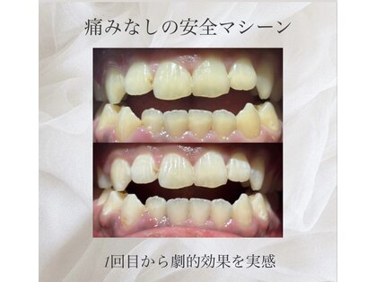 ホクリノ(Hokulino)の写真