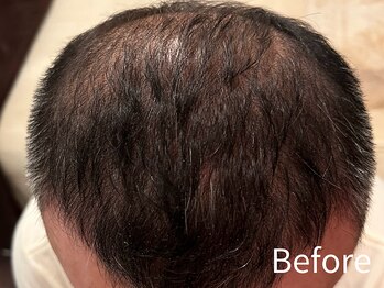 ダイヤモンド リーエンダ(Diamond leende)/クレイハーブピーリング