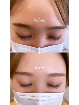 ビューティーアンドスパ セレクトプラス(Beauty & Spa treatment Select +)/強髪美容液（店販）効果