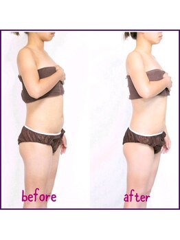 サットサンガ 表参道(SatSangah)/インドエステ全身/before after