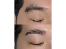 エトワールビューティー(ETOILE BEAUTY)