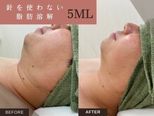 ソルニスデュオ(Solnis.-duo-)の雰囲気（【落ちない贅肉へ】針を使わない脂肪分解9,500円～【痩身/小顔】）