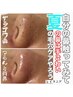 【美鼻】まるごと毛穴洗浄￥3300◆いちご鼻サヨナラ/古い角栓取ります！