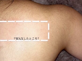 シンボディメイク 恵比寿(SiN BODY MAKE)/背中ワックス※光脱毛に変更可◎