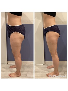 リッシュ(RICHE)/レモンボトル＆キャビゼロ