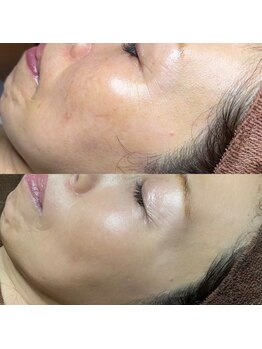 ホワラ 横浜店(Whila)/施術効果2