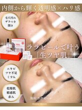 ソユ(SOYOU)/施術* &nbsp;&nbsp;&nbsp;&nbsp;&nbsp;&nbsp;&nbsp;ララピール