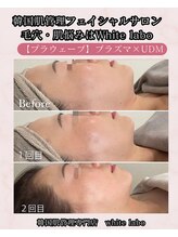 ホワイトラボ 梅田(White labo)/【プラウェーブ】プラズマ×UDM