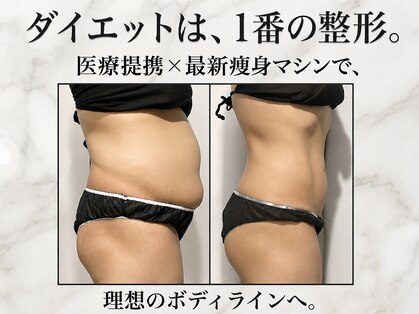 モテスリムの写真