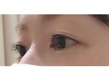 エーネイル エーラッシュ(A-NAIL A-LASH)/まつ毛パーマ【倉敷】