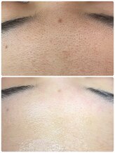 プアラ(puala)/エクストラクション