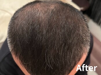 ダイヤモンド リーエンダ(Diamond leende)/クレイハーブピーリング