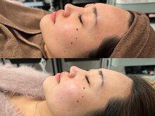 フェイン 青山店(fein.)/ツヤのあるお肌へ