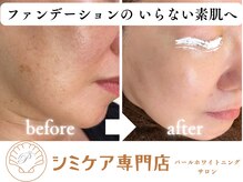 パールホワイトニングサロン 茅ヶ崎店