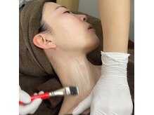 ネオビューティー(Neo beauty)の雰囲気（韓国発祥　☆第4世代《ララピール》でツヤ肌に！）