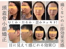 ヴィヴァーチェ(VIVACE)