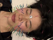 HariON｜鍼・開起の雰囲気（鍼灸/美容鍼/カイロプラクティック/整体/矯正/小顔/肩コリ/腰痛）