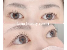 ラナビューティリゾート(Lana Beauty resort)/アップラッシュリフト