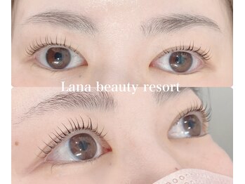ラナビューティリゾート(Lana Beauty resort)/アップラッシュリフト