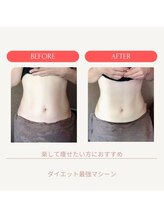 ミーティア(Meteor)/