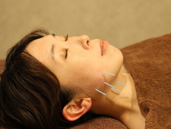 リバランスアンドビューティー整体院 西大宮院(ReBalance&Beauty整体院)の写真/年齢と共に気になる肌トラブルを改善。美容鍼灸で肌細胞の活性化を促し悩みを解消します！たるみ予防にも◎
