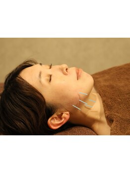 鍼灸施術を受けたい