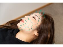 北梅田美容鍼灸院/【大阪/梅田】美容鍼灸