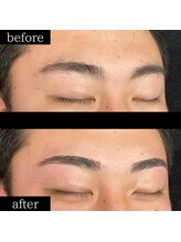 ユー 千葉駅前店(you)/症例写真