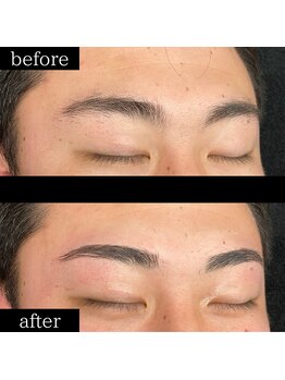 ユー 千葉駅前店(you)/症例写真