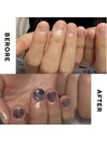 【美爪育成】深爪・噛み爪改善