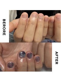 【美爪育成】深爪・噛み爪改善