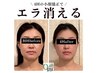 期間限定！！小顔頭蓋骨矯正＋オイル４回コース　￥39600→￥22800