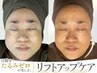 【8月限定】たるみへアプローチ。フェイスラインからグッと引き上げ小顔ケア!