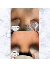 リミー(Reme)/最短でツルスベ肌が手に入る♪