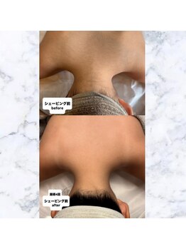 リミー(Reme)/最短でツルスベ肌が手に入る♪