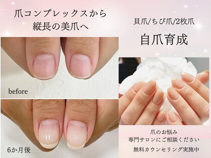 インブロッサム(imblossom)の写真