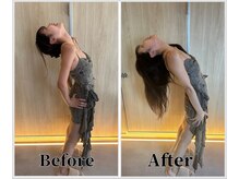 整体ラルース 中目黒(LALUZ)/20代　女性　猫背、巻き肩改善