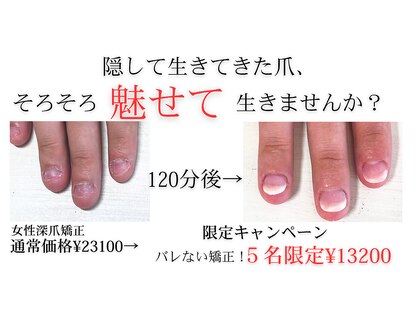 ヴェールリム(verl lim)の写真
