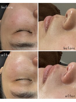 トロワ(trois.)/face wax