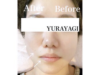 小顔屋ゆらやぎ/