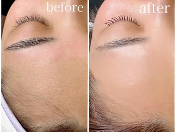 ソアラ(soara)/フェイシャルワックス脱毛+美眉