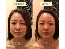 アジール 新潟市(agir)/Before/After画像