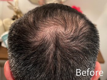 ダイヤモンド リーエンダ(Diamond leende)/クレイハーブピーリング