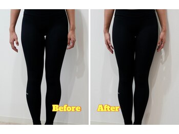 アズール(azure)/骨盤＆O脚の矯正