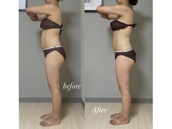 エヌボーテ(N. beaute)/全身4回モニターコース