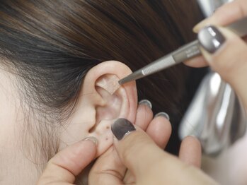 シュシュ(salon Chouchou)の写真/特別な日の為にベストの状態の自分を叶える★当店オリジナルの耳つぼブライダルコース!!理想の体型へ♪